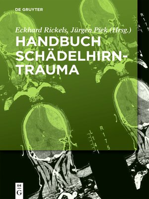 cover image of Handbuch Schädelhirntrauma
